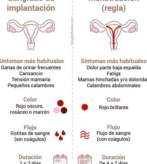 falsa regla que es y como identificarla