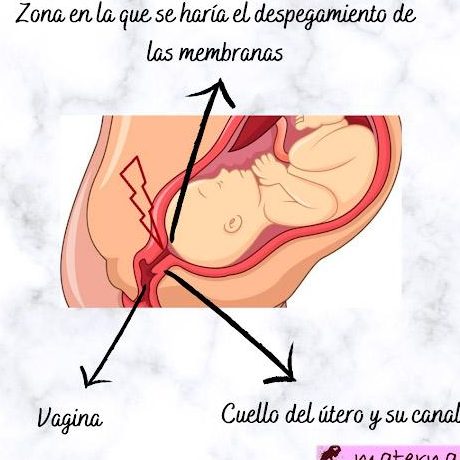 maniobra de hamilton que es y para que sirve